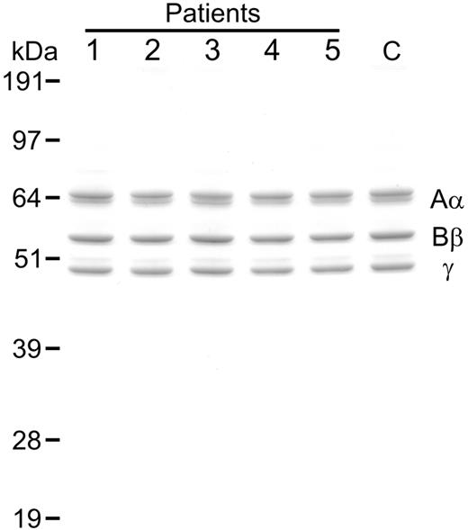Figure 2. Analysis of purified fibrinogen. Samples of variant fibrinogen (1 μg) from CTEPH patients (patients nos. 1-5) as well as normal fibrinogen from a representative healthy control (C) were subjected to SDS PAGE (10% reducing gel) followed by staining with colloidal blue. Mobilities of the fibrinogen chains (Aα, Bβ, γ) and molecular mass markers (kilodaltons) are shown.