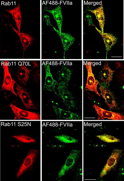 Figure 7. Involvement of rab11 in sorting the internalized FVIIa into the recycling compartment. CHO-EPCR cells were transiently transfected with wild-type rab11, constitutively active rab11 (Q70L), or dominant negative rab11 (S25N), and the transfected cells were exposed to AF488-FVIIa for 1 hour at 37°C. The cells were fixed, permeabilized, and immunostained for rab11. The fluorescence of internalized AF488-FVIIa and immunofluorescence of rab11 were analyzed by confocal microscopy.
