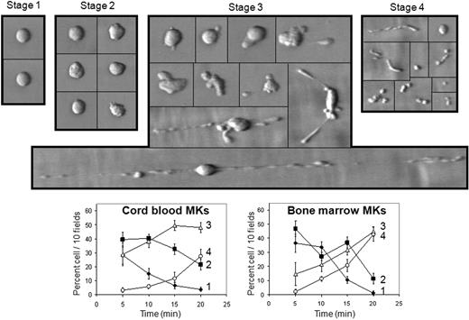 Figure 1. MK deformation on a VWF surface at high shear rate. Cells suspended in IMDM were perfused on VWF at 1800 s−1 for 10 minutes; then IMDM alone was perfused for 10 minutes. Adhesion led to major cell shape changes and to proplatelet formation. Microphotographs during perfusion indicate 4 different stages starting from undeformed MKs (stage 1) to early deformation characterized by loss of cell sphericity (stage 2); stage 3 includes later deformation of MKs with cytoskeletal reorganization at a cell pole or both ends, also a long thin filament of successive “beads on a thread”; stage 4 comprises fragmentation of proplatelets and cleavage from the nucleus, as well as platelet formation and release. Proportion of cells relative to the total number of cells counted in 10 fields was plotted as a function of perfusion time classified according to these 4 stages for cord blood MKs (bottom left panel) or bone marrow MKs (bottom right panel) perfused on VWF. Photographs are representative of 15 experiments, curves are mean (± SEM) of 8 experiments. The bar represents 10 μm. Black lines have been inserted to indicate repositioned images.