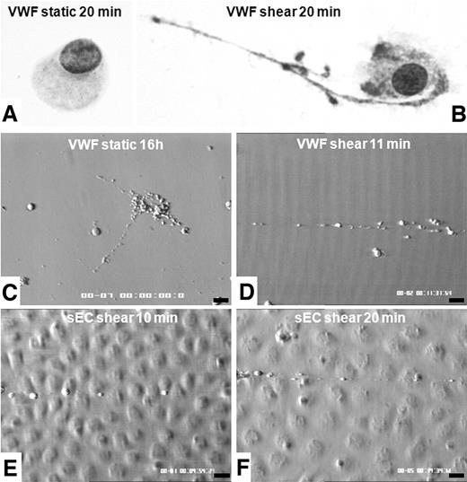 Figure 2. Comparison of shear or static conditions of MK deformations on a VWF-containing surface. Coverslips were removed from the flow chamber and rinsed with PBS before fixation in ice-cold methanol and subsequent Romanovsky staining (A-B, magnification ×500): during static 20-minute adhesion, cells displayed a spherical shape, without any proplatelet extension (A), but after exposure to high shear rate for 20 minutes, MKs extended long filopods at their tip and beaded platelet-like spikes were formed along the shaft (B). In separate experiments, images were recorded on coverslips coated with VWF (C-D) or on stimulated HUVECs (E-F) during real-time perfusion. Panel C shows proplatelet formation during 16 hours on VWF-coated slides in static conditions extending in different directions (C). In shear conditions, after 20 minutes, proplatelet formation is bipolar and organized along the flow (D). Similar organization of proplatelet formation is seen on UL-VWF released by HUVECs stimulated by IBMX and forskolin (E-F). Bars on panels C through F represent 10 μm.