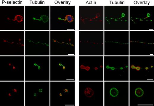 Figure 3. Distribution of α-granule proteins and tubulin in shear-induced proplatelets and platelets. Confocal microscope analysis of immunofluorescence showing labeling (left panels) with anti–P-selectin, anti-tubulin antibodies, and overlay of (from top to bottom) an MK extending a thick proplatelet, a long and thin proplatelet, a dumbbell-shaped proplatelet with its central narrowing, and 2 platelets. P-selectin staining is seen in organelles in forming proplatelets and in platelets in different spots, whereas tubulin stains the entire microtubule shaft of the proplatelet and the periphery of platelets. Right panels: labeling with phalloidin, anti-tubulin antibodies, and overlay of (from top to bottom) an MK extending proplatelet, a long and thin proplatelet with its shaft as well as its tip, labeled for tubulin, a dumbbell-shaped proplatelet with its central narrowing, and a platelet exhibiting a circular labeling pattern. No colocalization between actin and tubulin is visible. The bars represent 10 μm.