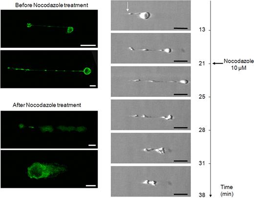 Figure 4. Reversal of proplatelet elongation by nocodazole addition during proplatelet elongation. Frames from experiment shown in supplemental Video 3 were selected from (top to bottom) before (13 minutes) and during elongation (21 minutes), after addition of nocodazole (at 21 minutes and 20 seconds), during effect of nocodazole (25 minutes), and at the start (28 minutes), during the progress (31 minutes), and at the completion (38 minutes) of elongation reversal. Notice the modifications between the cell body and its anchorage point (white arrow) during different steps. Confocal microscope analysis of indirect immunofluorescence labeling with anti-tubulin antibody of an MK extending proplatelet before and after nocodazole treatment. MKs exhibit diffuse staining after action of nocodazole, indicating tubulin depolymerization. Bars represent 10 μm.