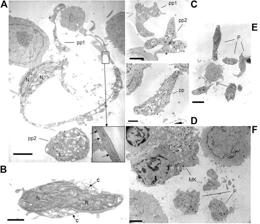 Figure 5. Ultrastructure of MKs exposed to high shear rates leading to platelet formation. Effluent cell suspensions (A-E) or alternatively cells present on the coverslips (F) were processed for electron microscopy as described in “Electron microscopy.” Mature MKs were elongated, extending an often unique long cytoplasmic filopod enclosing parallel longitudinal microtubules (inset). These proplatelets exhibited regular swellings containing cytoplasmic organelles. A large spherical cytoplasmic fragment, probably a detached proplatelet (pp) was located nearby (A). The nuclear lobes (N) containing dense chromatin were elongated and located at one pole of the cell. Naked nuclei with an oval shape and compact nuclear lobes containing dense chromatin, which are normally absent from MK cultures, were retrieved in the effluents (B). Proplatelets (pp) filled with cytoplasmic organelles appeared as large cytoplasmic fragments, devoid of nuclei, roughly spherical, dumbbell-shaped, or elongated with slender extremities (C-D). Several isolated platelet-sized fragments (P) were observed (E). Panel F shows the section of the cell monolayer present on a VWF-coated coverslip removed from the chamber after exposition to shear. It shows 2 platelet-sized fragments (P) located close to an adhering MK, displaying α granules and surface-connected canalicular system characteristic of platelets, and whose distribution pattern resembles that of the putative mother cell (MK). Scale bar represents 2 μm.