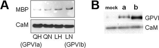 Figure 4. Binding of GPVI isoforms to CaM. (A) Binding of MBP-GPVI constructs to CaM in vitro. The ability of CaM to bind to MBP-GPVI cytoplasmic domain fusion proteins in vitro was measured by an immunoprecipitation assay. Four MBP constructs were compared, bearing each of the possible combinations of the 2 cytoplasmic domain amino acid substitutions at position 317 or 322. These are named QH (which represents native GPVIa), and QN, LH, and LN (representing native GPVIb). The components of the immunoprecipitates were separated by SDS-PAGE, and the relative content of MBP fusion protein was determined by Western blot with anti-MBP (top panel). Membranes were stripped and reprobed with anti-CaM antibody (bottom panel). (B) Binding of full-length GPVI isoforms to endogenous Dami cell CaM. We measured by immunoprecipitation the amount of rGPVI in lysates of stable Dami cell transfectants that is coprecipitated with endogenous CaM. Equal volumes of the normalized Dami cell lysates were precleared and incubated overnight with 4 μg of monoclonal anti-CaM. The resulting CaM/anti-CaM immune complexes were isolated by adsorption to fresh protein G agarose beads. Immune complexes were eluted from the beads with SDS electrophoresis buffer, and protein constituents were separated by SDS-PAGE and transferred to a nitrocellulose membrane for Western blot assay. The relative amount of rGPVI recovered was determined by Western blot using LJ6.5 (top panel). Membranes were stripped and reprobed with monoclonal anti-CaM to confirm that the amount of CaM present in each sample was equivalent (bottom panel). The transfected Dami cell lines expressed either rGPVIa (center lane) or rGPVIb (right lane). Mock-transfected cells served as a negative control (left lane).