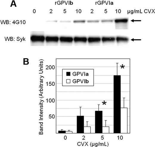 Figure 7. Dose dependence of Syk phosphorylation after CVX treatment. (A) Dami cells stably transfected with equivalent levels of rGPVIa or rGPVIb isoforms were incubated for 90 seconds in buffer containing 0, 2, 5, or 10 μg/mL CVX, and then lysed. Soluble proteins were isolated, and Syk was immunoprecipitated with specific antibody and electrophoresed on acrylamide gels, and then transferred to PVDF membranes. The presence of tyrosine-phosphorylated Syk was determined by Western blot (WB) using monoclonal anti-phosphotyrosine 4G10 (top panel). The position of Syk is indicated by the horizontal arrow to the right of the gel. The membranes were then stripped and reblotted with monoclonal antibody specific for Syk (bottom panel). These data are taken from one representative example of 3 independent experiments. (B) Cumulative data analysis from 3 independent experiments. The density of 4G10-probed bands was determined by optical image analysis, as described in the text. The mean band densities in arbitrary units (ordinate) derived from cells treated for 90 seconds with 0, 2, 5, or 10 μg/mL CVX (abscissa) are depicted as solid bars, in which ■ represent data obtained from Dami cell lines stably transfected with rGPVIa, and □ represent data obtained from cells transfected with rGPVIb. The vertical lines represent one standard deviation from the mean. The difference in mean band densities obtained from cells treated with 5 or 10 μg/mL CVX (∗) is statistically significant (P < .05).
