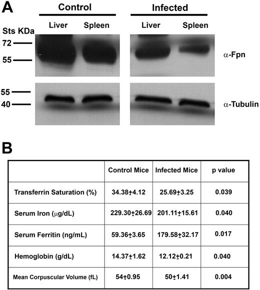 Figure 2. Mice infected with B burgdorferi are hypoferremic. (A) Homogenates of livers and spleens from uninfected and infected C3H mice with B burgdorferi were analyzed using rabbit antiferroportin antibody and mouse antitubulin antibody followed by a peroxidase-conjugated goat anti–rabbit antibody or goat anti–mouse antibody. (B) Serum was isolated from infected and uninfected C3H mice 4 weeks after injection with B burgdorferi. Transferrin saturation, serum iron, serum ferritin, hemoglobin, and mean corpuscular volume were analyzed as described in “Methods.”