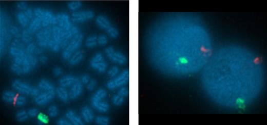 Figure 5. Virus-specific CTL derived from CB are of neonatal and not maternal origin. To confirm the origin of the virus-specific T-cell responses observed in the CB-derived CTL line CB3 were of neonatal and not maternal origin we used fluorescence in situ hybridization (FISH) with sex chromosome–specific probes. FISH probes specific to α satellite centromeric region of chromosome X labeled with spectrum orange and the satellite III (Yp12) region of chromosome Y labeled with spectrum green were obtained from Abbott Laboratories. Hybridization was performed according to the manufacturer's protocols. The slides were counterstained with 4,6-diamidino-2-phenylindole (DAPI) and the images were captured using 10×/25 aperture at magnification of 100×/1.40 oil R on Nikon E800 microscope equipped with a cooled-charge coupled device (CCD) camera. The cells were analyzed using Quips Pathvysion (Applied Imaging). A total of 200 interphase nuclei and 5 metaphase spreads were analyzed for sex chromosome signal pattern.