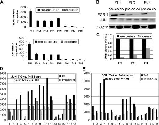 Figure 1. Osteoclasts and MSCs down-regulated JUN and EGR-1 in myeloma plasma cells. (A-C) Primary myeloma plasma cells from 8 patients were cultured in the presence (coculture) or absence (pre-coculture) of osteoclasts for 2 days. (A) JUN and EGR-1 gene expression levels in these cells were evaluated by real-time PCR, expressed as relative values by the comparative Ct method. (B) Protein levels of JUN and EGR-1 were determined by Western blot analysis in 3 patient samples, shown in panel A, that had sufficient quantities of protein extracts available. Protein levels were compared in cultured cells in the presence (co) or absence (pre-co) of osteoclasts. β-Actin was used as a loading control. (C) JUN binding activity was evaluated in nuclear extracts of the same 3 samples of myeloma plasma cells shown in panel B by the use of an ELISA-based assay (expressed as relative value compared with each control); each sample is expressed as the mean ± SEM of 2 duplicates. JUN (D) and EGR-1 (E) gene expression from GEP data of myeloma cells cultured with (t = 18 hours) or without (t = 0 hours) MSCs.