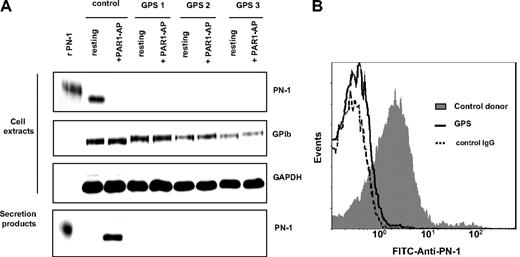 Figure 2. PN-1 is stored in platelet α-granules. (A) Washed platelets from control donors or patients with a GPS were activated by 50μM PAR1-AP for 30 minutes at 37°C and centrifuged to separate platelet pellets from supernatants. Platelet pellets (cell extracts) and supernatants (secretion products) were analyzed by Western blot for PN-1, GAPDH, and GPIb. (B) Washed platelets from control donor or GPS patients were analyzed by flow cytometry with an FITC-coupled anti–PN-1 IgG. Data are representative of 3 separate experiments from different donors.