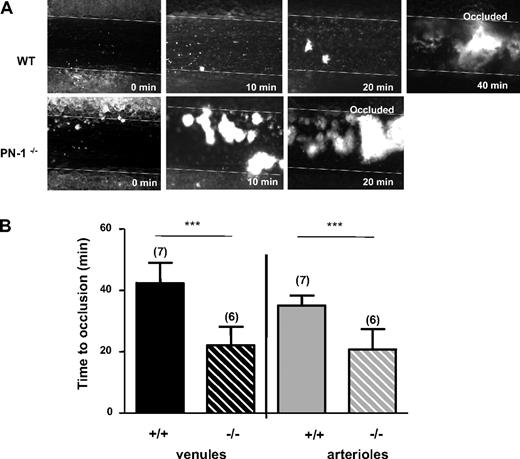 Figure 7. In vivo thrombus formation. (A) Representative images of FeCl3-injured mesenteric venules in WT and PN-1–deficient mice. Thrombus formation was visualized in real time using an inverted epifluorescent microscope (Nikon Eclipse TE 2000-U) using a lens at 20×/0.5 (Nikon). Images were acquired using a CCD CoolSNAP HQ2 camera (Photometrics/Roper Scientific) and processed with Metamorph 7.0r1 software (Universal Imaging Corporation). (B) Time to occlusion of mesenteric venules (black histograms) and arterioles (gray histograms) was measured after application of FeCl3 in WT mice and PN-1−/− mice. Data are the mean ± SD for the number of mice indicated in parentheses. ***Significant difference (P < .001) versus WT.
