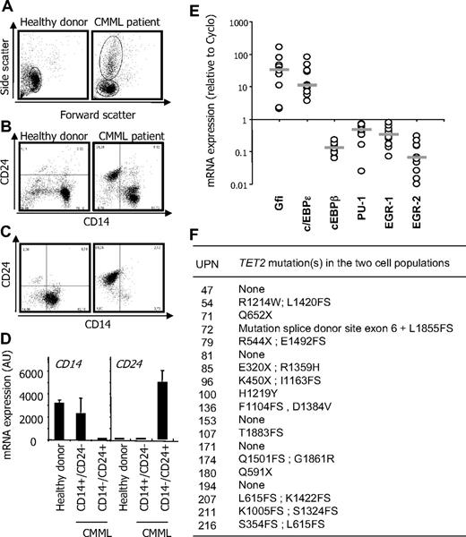 Figure 1. CMML peripheral blood mononuclear cells. (A-B) Peripheral blood mononuclear cells were selected from a healthy donor (control) and a CMML patient before AutoMacs negative selection for monocyte enrichment. (A) Side/forward scatters were analyzed by flow cytometry. (B) Flow cytometric analysis of CD14 and CD24 identifying CD14+/CD24− in the healthy donor and an additional population of CD14−/CD24+ cells in the CMML sample. (C) CD14+/CD24− and CD14−/CD24+ CMML cells were further enriched through positive selection based CD14 expression. (D) RQ-PCR analysis of CD14 and CD24 gene expression in cells sorted as in panels B and C (mean ± SD of triplicates). Each panel shows 1 representative of 20 samples. (E) RQ-PCR analysis of indicated genes in CD14+/CD24− and CD14−/CD24+ cells sorted from 10 patients. Expression normalized to 1 in CD14+/CD24−; the ratio of expression in CD14−/CD24+ cells is shown. Bar represents median. (F) TET2 gene sequence was analyzed in CD14+/CD24− and CD14−/CD24+ cells sorted from 19 patients. Indicated abnormalities were found in all cases in the 2 cell populations.