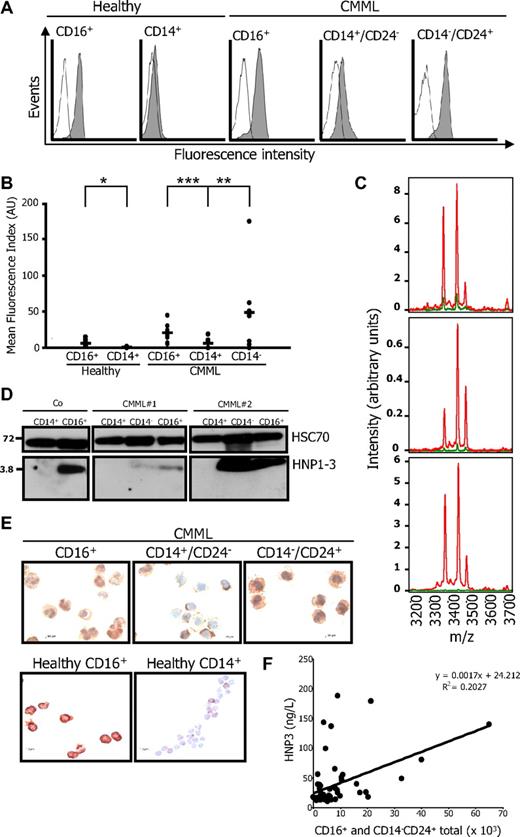 Figure 3. Synthesis and secretion of HNP1-3. (A-B) HNP1-3 expression in permeabilized healthy monocytes and neutrophils (CD16+) and CD14+/CD24− (CD14+) and CD14−/CD24+ (CD14−) cells sorted from CMML. (A) One representative series of samples. (B) A series of 10 normal and 10 CMML samples was studied (mean fluorescence index reported to the control antibody; *P = .006; **P = .005; ***P = .001). (C) MS analysis of proteins secreted by CD14−/CD24+ (red lines) and CD14+/CD24− (green lines) cells sorted from 3 representative CMML samples cultured for 6 hours in serum-free medium. (D) Immunoblot analysis of HNP1-3 in healthy donor (Co) CD14+ monocytes and CD16+ granulocytes, and in CD14−/CD24+, CD14+/CD24−, and CD16+ cells sorted from 2 CMML patients. (E) HNP1-3 was also examined by immunochemistry on cytospins of CD16+, CD14+/CD24−, and CD14−/CD24+ CMML cells and CD16+ granulocytes and CD14+ monocytes of healthy donors. (F) Correlation between HNP1-3 plasma level and the absolute number of granulocytes (including morphologically recognized polymorphonuclear cells and CD14−/CD24+ cells) in 47 patients with CMML.