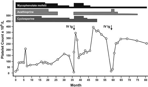 Figure 2. Representative patient with refractory ITP who responded to the combination of azathioprine, mycophenolate mofetil, and cyclosporine. Attempts at gradual dose reductions and discontinuation of azathioprine and subsequently cyclosporine each resulted in relapses. The height of the bar for each medication represents relative dosages. IVIg indicates intravenous immunoglobulin.