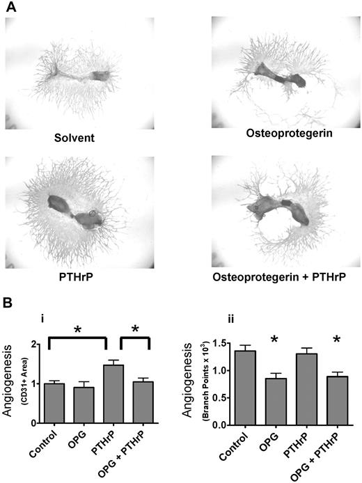 Figure 2. Osteoclast stimulation increases angiogenesis in bone explants. (A) PTHrP stimulates angiogenic outgrowth from metatarsal explants by a mechanism requiring osteoclasts. Whole-mount fetal metatarsal explants from outbred mice cultured for 15 days with 3 μg/mL rh OPG-Fc or 100nM PTHrP as indicated. Images acquired as whole mounts in water with an Olympus IX71 microscope with a Plan N 2x objective, NA of 0.06, and a Spot RTKE camera with Spot Advanced software (original magnification × 2). (B) Quantification of angiogenic response to PTHrP and OPG. Angiogenesis was quantified by measurements of total CD31+ area (i) or angiogenic tube formation (branches; ii). Data are mean ± SEM. *P < .05. Similar results were seen in 2 experiments. Results are from 1 representative experiment of 2 performed.
