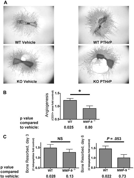 Figure 3. MMP-9 is important for stimulation of angiogenesis by osteoclasts in bone explants. (A) PTHrP-induced metatarsal angiogenesis is blunted in Mmp9−/− explants. Sample (original magnification ×2) images of WT or Mmp9−/− C57BL/6 metatarsal explants treated with vehicle or 100nM PTHrP as indicated and stained for CD31. Images acquired as in Figure 2. (B) Angiogenic response to PTHrP is significantly less in Mmp9−/− than in WT metatarsal explants. Metatarsals from 7 WT and 6 Mmp9−/− litters were treated with 100nM PTHrP or vehicle. The mean fold change from control in CD31+ area per litter for all litters ± SEM is reported. *P < .05, difference in treatment response between genotypes. PTHrP significantly stimulated angiogenesis in WT but not in Mmp9−/− metatarsals, as determined by the ratio t test comparing vehicle and PTHrP-treated means for each litter. (C) PTHrP increases bone resorption in WT but not in Mmp9−/− metatarsal explants. CTX assayed from conditioned media collected from days 1 to 3 or 4 to 6 of culture of all 7 WT and 6 knockout litters and reported as mean fold change from control. *P < .05, treatment response compared with vehicle. NS indicates not significant.