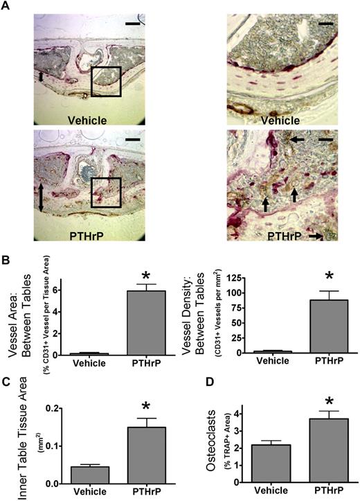 Figure 4. PTHrP increases bone angiogenesis in vivo. (A) Stimulation of osteoclast activity by PTHrP increases angiogenesis in mouse calvaria in vivo. Coronal sections of calvaria from mice treated with PTHrP(1-34) every 6 hours for 5 days, labeled for CD31 (brown) and TRAP (red), and lightly counterstained with hematoxylin. indicates prominent CD31+ vessel; 2-headed arrow, inner table thickness. Outer surface is at the top of the image. Images of aqueous mounted slides acquired with a Nikon Eclipse TE300 microscope using a 20×/0.45 NA Plan Fluor objective and a Spot Pursuit camera with Spot Advanced 6.4 software. Scale bar represents 100 μm for full field, 25 μm for insets. Auto contrast and auto color adjustment were performed with Adobe Photoshop software. (B) PTHrP increases CD31+ vessel density between calvarial bone tables. Total vessel area and vessel density quantified by grid map counting by a blinded observer of the parasagittal areas of CD31-stained calvarial sections. (C) PTHrP increases thickness of inner table. Total tissue area of the inner table was quantified by image analysis by a blinded observer. (D) PTHrP induces osteoclast formation in calvaria. Total TRAP+ area as a percentage of tissue area was quantified by image analysis by a blinded observer. Data are mean ± SEM. *P < .05 compared with vehicle. Results are from 1 representative experiment of 2 performed.
