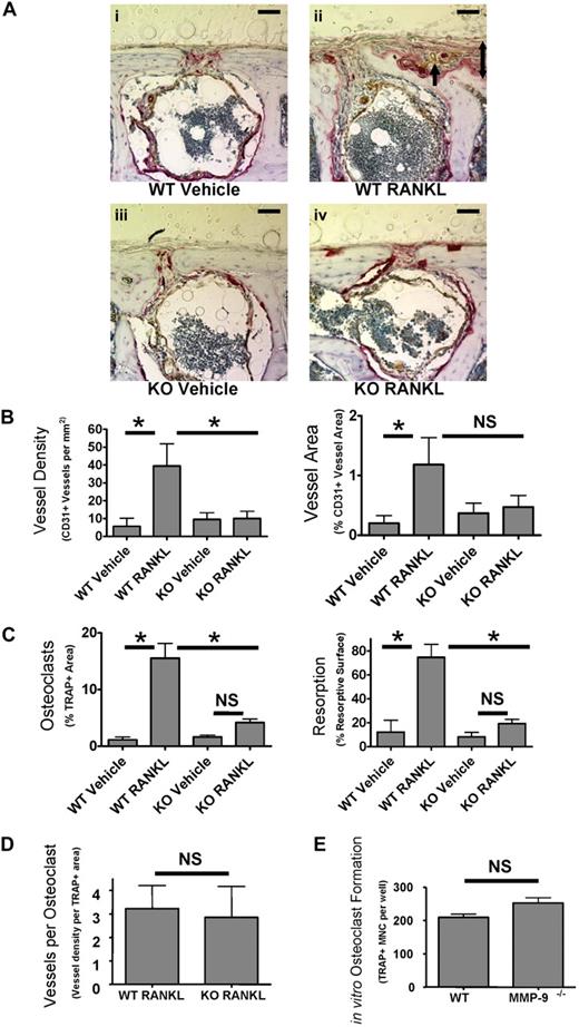 Figure 5. MMP-9 is important for stimulation of bone angiogenesis by osteoclasts in vivo. (A) Supra-calvarial RANKL increases angiogenesis and osteoclast formation to a greater extent in calvaria of WT than Mmp9−/− mice. Images of the outer table of calvarial sections stained for TRAP (red) and CD31 (brown) and lightly counterstained with hematoxylin. Images are WT vehicle-treated (i), WT RANKL-treated (ii), Mmp9−/− vehicle-treated (iii), or Mmp9 −/− RANKL-treated (iv). Images were acquired as in Figure 4. indicates CD31+ vessel in remodeling bone; 2-headed arrow, thickness of RANKL-induced bone remodeling. Scale bars represent 50 μm. Outer surface is at the top of the image. Auto contrast and auto color adjustment were performed with Adobe Photoshop software. (B) Quantification of RANKL-induced vessel response by calculation of CD31+ vessel density or area in the outer table of 10× objective images taken at the calvarial midline. (C) Total percentage TRAP+ area of the calvarial outer table or resorptive surface of the outer table subperiosteal surface. (D) Vessels per osteoclast were calculated by dividing vessel density by TRAP+ area for each RANKL-treated animal. (E) In vitro osteoclast formation from bone marrow from WT and Mmp9−/− C57BL/6 mice was quantified by counting TRAP+ multinucleated cells. Data are mean ± SEM. *P < .05. NS indicates not significant.