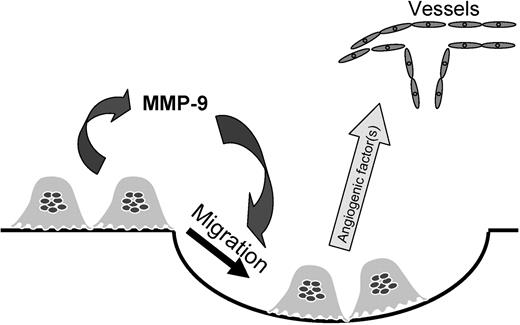 Figure 7. Role of MMP-9 in osteoclast-stimulated angiogenesis. In this model, osteoclasts release MMP-9, which induces osteoclast migration to increase local osteoclast numbers and activity. The osteoclasts then secrete factors that increase angiogenesis.