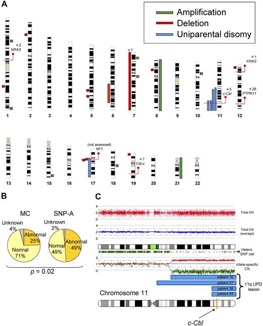 Figure 1. Single nucleotide polymorphism array–based karyotyping of JMML. (A) Genomic distribution and type of lesion identified in patients with JMML by SNP-A analysis. Green bar represent amplification, red shows deletion, and blue corresponds to UPD. Red lines pinpoint the locus of genes discussed in the text, as well as the number of patients mutated at that locus. NF1 mutational status was not assessed in this cohort. (B) Increased sensitivity of SNP-A for detecting chromosomal lesions. The results of MC (25%) and by SNP-A (49%) from the JMML cohort studied are shown. (C) Representative 250-K SNP-A analysis of UPD11q by CNAG Version 3.0 (patient 16). Both the raw and averaged total copy number (CN) tracks (red dots, blue line) show a normal copy number, whereas heterozygous SNP calls and allele-specific copy number tracks (green dashes, red/green lines) show a reduction in copy number, indicating UPD. The specific localization of 11qUPD in 4 patients (patients 16, 27, 38, and 43) is indicated by the blue bars. The c-Cbl locus is indicated on the chromosome 11 idiogram with a yellow line.