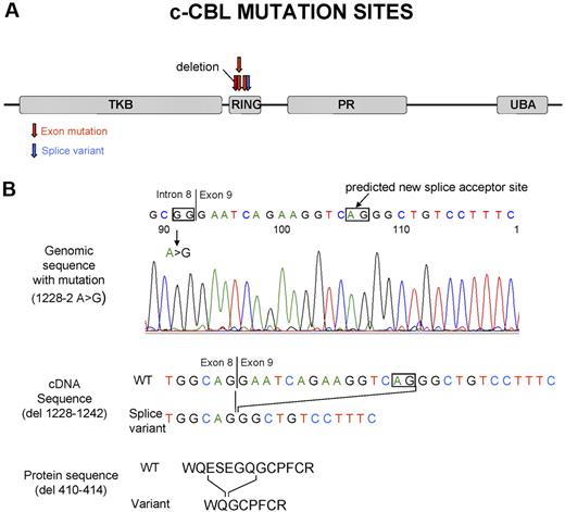 Figure 2. Site of the c-Cbl mutations and predicted product of splice variant in the intron 8 splice acceptor site. (A) Localization of the c-Cbl mutations within the predicted protein product. Red arrows show the site of mutations in exon, and blue arrows show the site of splice variant. (B) In patient 48, a homozygous mutation was seen in the intron 8 splice acceptor site of c-Cbl. According to http://genome.cbs.dtu.dk/services/NetGene2,34 this mutation may result in a splice variant, leading to a shorter transcript in RF domain.