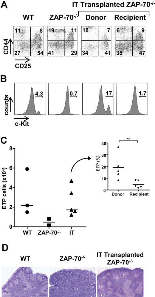 Figure 6. IT BM transplantation results in increased WT c-Kithigh thymic precursors and a high progenitor niche occupancy. (A) The phenotype of immature donor thymocytes was assessed in ZAP-70−/− mice 25 weeks after IT administration of WT CD45.1+ BM progenitor cells. CD25/CD44 profiles of donor CD45.1+ and recipient CD45.1− TN thymocytes were evaluated to distinguish TN1, TN2, TN3, and TN4 populations, and representative dot plots are shown. Control dot plots of TN thymocytes from CD45/1+ WT and ZAP-70−/− mice not receiving a transplant are shown. (B) The presence of early progenitors within gated CD44+/CD25− TN1 thymocytes was assessed by c-Kit staining. (C) Graph shows the absolute numbers of c-Kithigh thymocytes within the TN1 subset of WT, ZAP-70−/−, and intrathymically reconstituted ZAP-70−/− mice. The graph in the inset shows the relative percentages of c-Kithigh thymocytes within the donor and recipient populations from ZAP-70−/− mice that received an IT transplant (n = 5). **P = .008. (D) Hematoxylin and eosin staining of transverse thymus sections from WT, ZAP-70−/−, and intrathymically reconstituted ZAP-70−/− mice. Thymi from WT, but not ZAP-70−/−, mice are normally structured with densely packed cortical regions and less dense medullary regions, whereas thymi from intrathymically reconstituted mice show the formation of an extensive medulla.