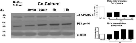 Figure 2. Expression of DJ-1 and p53 proteins as determined by LC-MS/MS/PhosphoScan method. DJ-1/PARK-7 protein levels in KG1a cells with or without coculture with HS5 stroma at 0.5, 1, 4, and 18 hours were determined by Western blot (left) and confirmed by densitometry (right). There was a strong correlation between the decrease in DJ-1 over time in KG1a cells after coculture with HS5 stroma and an increase in protein levels of p53 as determined with anti–serine 46 phospho antibodies. The increase in p53 was associated with an increase in apoptosis (see Figure 5A). One of 3 identical experiments is shown.
