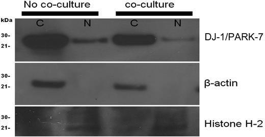 Figure 3. Cellular localization of DJ-1/PARK-7 and p53 in KG1a cells. KG1a cells before coculture showed more prominent DJ-1 in the nucleus (N) than after coculture. Included were loading controls for cytoplasm (C; β-actin) and nucleus (N; Histone H-2A).