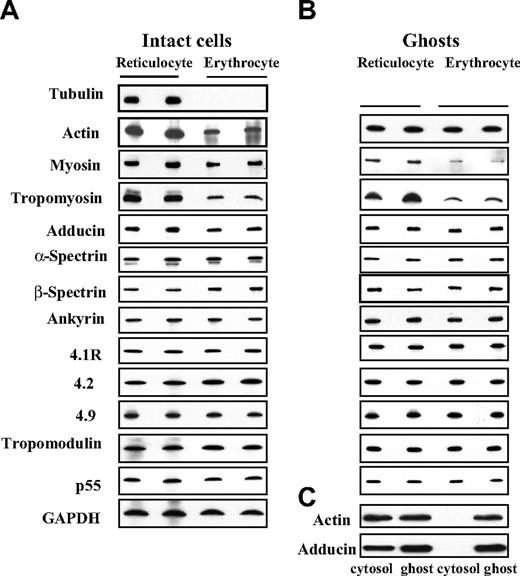 Figure 1. Immunoblots of cytoskeletal proteins of reticulocytes and erythrocytes. (A) Intact cells: Western blots of SDS-PAGEs of total cellular protein prepared from reticulocytes and erythrocytes probed with antibodies against the indicated proteins. Note the absence of tubulin and the decreased expression of tropomyosin, myosin, actin and adducin in erythrocytes. (B) Ghosts: Western blots of SDS-PAGEs of ghosts prepared from reticulocytes and erythrocytes probed with antibodies against the indicated proteins. Because ghosts of both reticulocytes and erythrocytes do not contain any tubulin, there is no corresponding panel for tubulin in panel B. Note the decreased expression of tropomyosin and myosin in the erythrocyte membranes but the similar level of actin and adducin. (C) Western blots of SDS-PAGEs of the cytosol and the membrane were probed with anti-actin or anti-adducin antibody. Note actin and adducin are present in both the cytosol and the membrane fraction of reticulocytes but are only present in the membrane of erythrocytes.