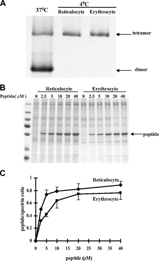 Figure 3. Protein-protein associations in reticulocytes and erythrocytes. (A) Spectrin dimer-tetramer equilibrium in reticulocytes and mature red blood cells. Extracted spectrin was analyzed by nondenaturing gel electrophoresis. Note spectrin from both the reticulocytes and the erythrocytes is tetrameric. In panels B and C, incorporation of a β-spectrin fragment into reticulocyte and erythrocyte membranes. The Triton shells were prepared from reticulocyte or erythrocyte ghosts resealed with increasing concentrations of β-spectrin fragment 1-301. (B) Proteins retained in the Triton shells were analyzed by SDS-PAGE. (C) Quantitative analysis revealed greater incorporation of the peptide into the cytoskeleton of reticulocytes compared with that observed in erythrocytes.