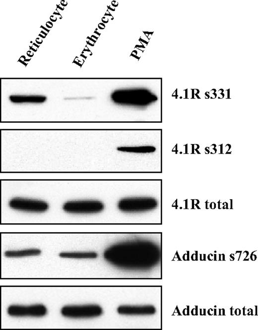 Figure 4. Phosphorylation of 4.1R and adducin in reticulocytes and erythrocytes. Reticulocyte and erythrocyte ghosts were prepared in the presence of the phosphatase inhibitor, calyculin A. Western blots of SDS-PAGEs were probed with phospho-residue specific antibodies as indicated. PMA-treated erythrocyte ghosts were used as a positive control. Note the markedly increased phosphorylation of 4.1R at residue 331 serine (4.1R s331) in reticulocytes.