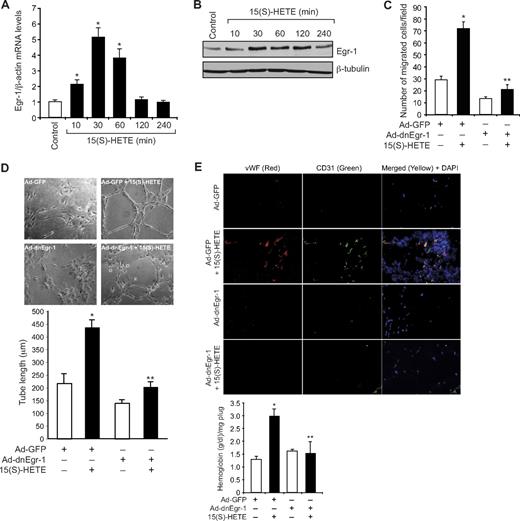 Figure 1. Egr-1 mediates 15(S)-HETE–induced HDMVEC migration and tube-like structure formation in vitro and Matrigel plug angiogenesis in vivo. (A-B) Quiescent human dermal microvascular endothelial cells (HDMVECs) were treated with and without 15(S)-hydroxyeicosatetraenoic acid (15(S)-HETE; 0.1μM) for the indicated time periods, and either RNA was isolated or cell extracts were prepared. (A) RNA was analyzed by QRT-PCR for Egr-1 and β-actin mRNA levels. (B) Cell extracts were analyzed by Western blotting for Egr-1 levels by the use of its specific antibodies. The blot was reprobed with anti–β-tubulin antibodies for normalization. (C-D) HDMVECs were transduced with Ad-GFP or Ad-dnEgr-1 at a moi of 40, quiesced, and subjected to 15(S)-HETE–induced migration (C) or tube-like structure formation (D). (E) C57BL/6 mice were injected subcutaneously with 0.5 mL of Matrigel premixed with vehicle or 5μM 15(S)-HETE along with and without Ad-GFP or Ad-dnEgr-1 (5 × 109 pfu/mL). One week later, the animals were sacrificed, and the Matrigel plugs were harvested from underneath the skin and either processed for von Willebrand Factor (vWF) and CD31 expression by double immunofluorescence staining with their specific antibodies or analyzed for hemoglobin content with Drabkin reagent. The bar graphs in panels A, C, D, and E represent the quantitative analysis of 3 independent experiments or 6 plugs from 6 animals. The values are presented as the mean ± SD. *P < .01 vs control or Ad-GFP; **P < .01 vs Ad-GFP + 15(S)-HETE.