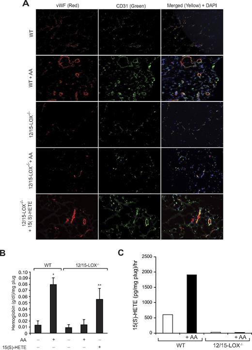 Figure 8. 12/15-LOX−/− mice show lack of angiogenic response to AA. (A-B) Wild-type and 12/15-LOX−/− mice were injected subcutaneously with 0.5 mL of Matrigel premixed with vehicle, 5μM AA, or 5μM 15(S)-HETE as indicated. One week later, the animals were sacrificed, and the Matrigel plugs were harvested from underneath the skin and either processed for vWF and CD31 by double immunofluorescence staining by the use of their specific antibodies (A) or analyzed for hemoglobin content with Drabkin reagent (B). (C) Wild-type and 12/15-LOX−/− mice were injected subcutaneously with 0.5 mL of Matrigel premixed with vehicle or 5μM AA. One week later, the Matrigel plugs were retrieved from animals, minced, incubated with 10μM AA and 10μM ionomycin, and 15(S)-HETE production was measured by EIA. The bar graphs represent the quantitative analysis of 6 plugs from 6 animals. The values are presented as the mean ± SD. *P < .01 vs WT control. **P < .01 vs WT control or 12/15-LOX−/− control or 12/15-LOX−/− + AA.
