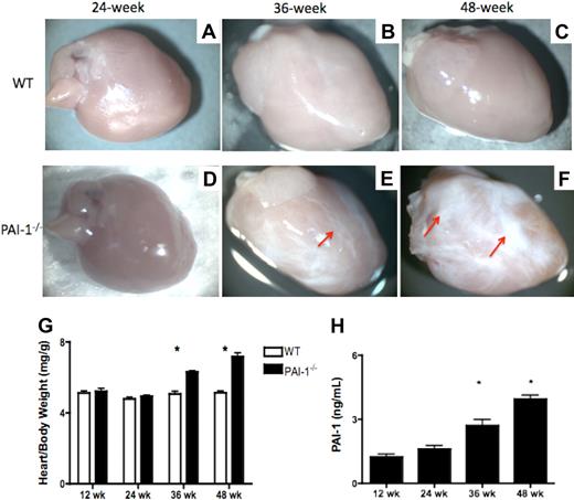 Figure 1. PAI-1 deficiency causes spontaneous cardiac fibrosis formation. (A-F) Macroscopic views of hearts from WT and PAI-1−/− mice. (A-C) WT hearts at 24, 36, and 48 weeks, respectively. None of the WT hearts at any time point examined developed fibrosis. (D-F) PAI-1−/− hearts at 24, 36, and 48 weeks, respectively. PAI-1−/− mice at 36 and 48 weeks developed obvious cardiac fibrosis. The fibrotic patches (red arrows) show a loss of normal architecture, paucity of stromal cells, and replacement of essential parenchymal structures by dense, pale, and increasingly rigid tissue. (G) Cardiac fibrosis formation caused an increase in the heart–body weight ratio (mg/g) in PAI-1−/− mice with aging, compared with WT mice. (H) PAI-1 antigen levels in plasma. n ≥ 8 for each age group; *P < .05.