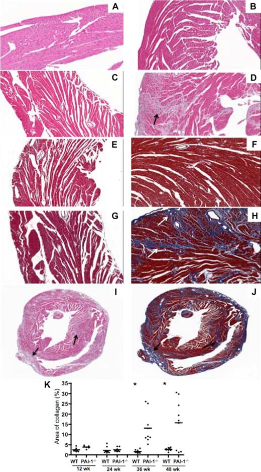 Figure 2. Histochemical characterization of interstitial cardiac fibrosis in hearts of PAI-1−/− mice. H&E staining of WT hearts at (A) 12 and (B) 48 weeks, and PAI-1−/− hearts at (C) 12 and (D) 48 weeks. At 48 weeks, replacement of cardiomyocytes by connective tissue was observed in PAI-1−/− hearts (black arrow). Masson trichrome staining of WT hearts at (E) 12 and (F) 48 weeks, and PAI-1−/− hearts at (G) 12 and (H) 48 weeks revealed extensive interstitial collagen deposition (white arrow, blue staining) in 48-week PAI-1−/− hearts. Although 12-, 24-, 36-, and 48-week hearts were examined, only 12- and 48-week hearts are shown in this figure. Global view of 48-week PAI-1−/− hearts with H&E staining (I) and Masson trichrome staining (J) revealed that fibrosis formation (black arrow) was rather pervasive throughout the entire heart. (K) Quantification of collagen by Masson trichrome staining of hearts. Data points represent individual hearts, and bars are group means. n ≥ 4 for each age group; *P < .05.
