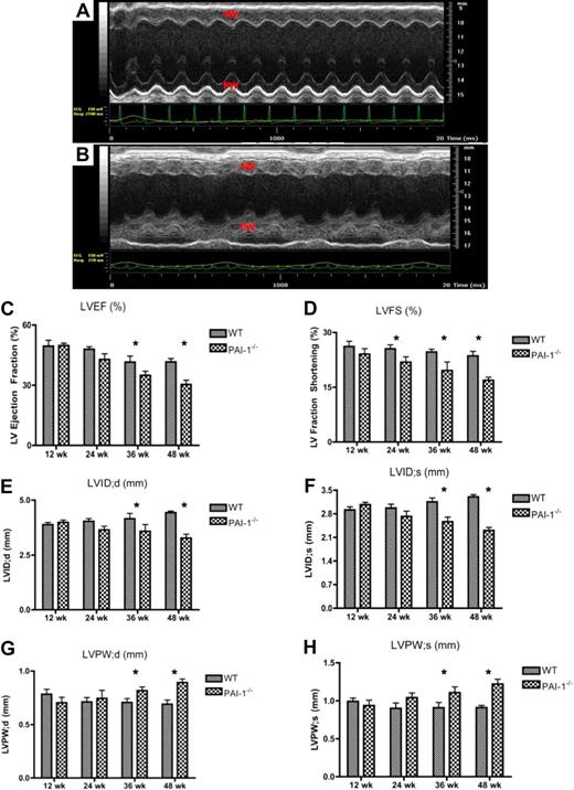 Figure 3. Echocardiographic evaluation of cardiac anatomy and cardiac function in WT and PAI-1−/− mice. Representative M-mode images of the short-axis view of the 48-week WT (A) and PAI-1−/− (B) LVs. Substantial LV wall motion irregularities were found in 48-week-old PAI-1−/− mice, demonstrated by severe reductions and odd movements in both systolic and diastolic LV posterior and anterior wall movements. AW indicates anterior wall; and PW, posterior wall. The overall left ventricular function, measured by left ventricle ejection fraction (LVEF; C) and left ventricle fractioning shortening (LVFS; D), was diminished by a PAI-1 deficiency, especially after 36 weeks of age. The internal diameters of LV at diastole and systole were decreased in PAI-1−/− mice, especially after 36 weeks (E-F). The LV posterior wall diameter was increased in PAI-1−/− mice at both systole and diastole (G-H). n ≥ 6 for each age group; *P < .05.