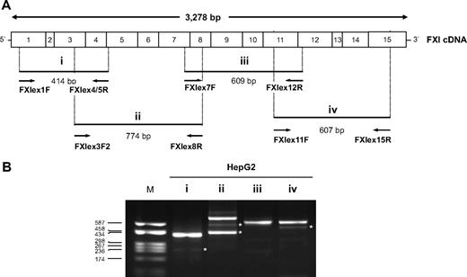Figure 1. Global screening of the F11 splicing pattern. The existence of physiologic F11 alternatively spliced transcripts was first assayed in HepG2 cells. (A) Schematic representation of the FXI cDNA. The position of the primer couples used for each RT-PCR assay (indicated with i-iv), and the expected length of the corresponding amplification products are also indicated. (B) RT-PCR products obtained with each primer couple (i-iv) separated on a 2% agarose gel. Lane M indicates molecular weight marker (pUC8-HaeIII). *AS products whose existence was confirmed by at least one sequenced recombinant clone. No clone with an insert compatible with the length of the faint upper band in lane ii was found.