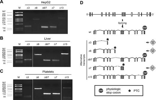 Figure 2. Characterization of F11 alternatively spliced transcripts. AS of the F11 pre-mRNA was analyzed in HepG2 cells (A), human liver (B), and platelets (C) by RT-PCR using primer couples specific for each identified splicing isoforms (Δ3-Δ13). Lane M indicates molecular weight marker (pUC8-HaeIII). (D) Schematic representation of the F11 gene and of its splicing pattern. Boxes represent exons; lines, introns; broken lines, splicing events; hatched lines, ASs; dead-end sing, out-of-frame splicings leading to the introduction of a PTC (star); and stop sign, physiologic stop codons.