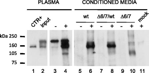 Figure 6. Immunoprecipitation of FXI Δ6/7 isoform from normal plasma. FXI present in plasma and in media of COS-1 cells transfected with pcDNA3/FXI, or pcDNA3/FXI-Δ6/7 was immunoprecipitated using both goat anti–human FXI antibody and mouse anti–human FXI (data not shown). Samples were analyzed on 6% nonreducing SDS-PAGE, and Western blotting was performed using polyclonal goat anti–human FXI peroxidase-conjugated IgG. The pcDNA3 empty vector was used as negative control (mock). + represents presence of goat anti–human FXI antibody; −, absence of goat anti–human FXI antibody; CTR+, 2 ng of commercially available human FXI; and input, 10 μL of normal plasma before the immunoprecipitation step.