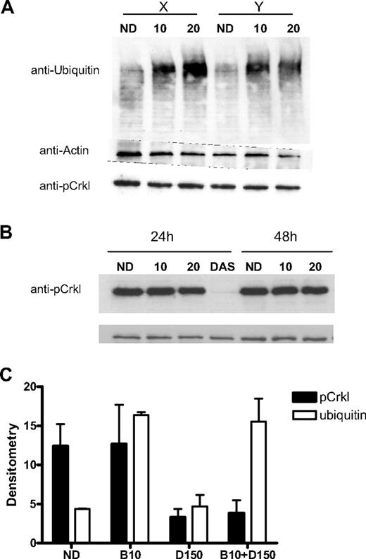 Figure 2. Effect of bortezomib on proteasome and BCR-ABL activity. (A) CML CD34+ samples (n = 2) labeled X and Y were treated for 24 hours with bortezomib 10 or 20nM (10,20) and compared with an untreated control (ND). Accumulation of polyubiquitinated proteins of various molecular weights was seen. Protein loading was assessed using antiactin antibody. The presence of significant BCR-ABL activity represented by the pCrkl band can be seen in all samples. (B) A representative CML CD34+ sample treated with bortezomib 10 or 20nM (10, 20) or dasatinib 150nM (DAS) for 24 to 48 hours and compared with untreated control (ND). The presence of the pCrkl band demonstrates the significant residual BCR-ABL kinase activity in PI-treated samples compared with the abrogated activity in the TKI-treated sample. (C) Densitometry of pCrkl (■) and ubiquitin (□) relative to protein loading control for 3 samples is shown after bortezomib 10nM (B10), dasatinib 150nM (D150), and combination treatment (mean ± SEM).