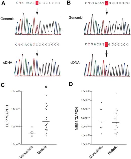 Figure 1. DLK1 allelic expression patterns in AML. (A) Monoallelic DLK1 expression. Genomic DNA sequencing (top) showing informative SNP at rs#1802710; cDNA sequencing (bottom) shows monoallelic expression (part #8107). (B) Biallelic DLK1 expression. Genomic DNA sequencing (top) showing informative SNP at rs#1802710; cDNA sequencing (bottom) shows biallelic expression (part #8101). (C) Comparison of DLK1 expression in patients with monoallelic (7 patients) and biallelic (22 patients) DLK1 expression. *P < .002. DLK1 levels were normalized using GAPDH. (D) Comparison of MEG3 expression in patients with monoallelic and biallelic DLK1 expression (P = .52). MEG3 levels were normalized using GAPDH.