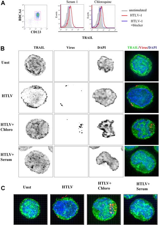 Figure 4. 3D analysis of TRAIL localization by HTLV-1–activated pDCs. (A) Freshly purified CD123+BCDA4+ pDCs (96%, left) stimulated by HTLV-1 express TRAIL on their membrane (middle and right, red histograms) that is significantly reduced by both HTLV-1–infected patient serum containing HTLV-1 blocking antibody (middle, blue histogram) and chloroquine (right, blue histogram). (B) Unstimulated pDCs (Unst), HTLV-1–stimulated pDC (HTLV-1) treated with chloroquine (HTLV-1 + Chloro) or with blocking HTLV1-infected patient serum (HTLV-1 + Serum) were stained with anti-TRAIL (green) and anti–HTLV-1 virus (red). pDC stainings (green and red) were merged with DAPI (blue)–colored nucleus (Overlay) or with phase contrast (Bright). HTLV-1–activated pDCs (HTLV-1) showed a TRAIL relocalization to cell surface in contrast to unstimulated pDCs (Unst). TRAIL surface localization (green) induced by HTLV-1 was inhibited in the presence of the HTLV-1 blockers (HTLV-1 + Chloro and HTLV-1 + Serum). Inhibition of endosomal acidification (chloroquine) allowed easier detection of HTLV-1 virions (HTLV-1 + Chloro) in contrast to few HTLV-1 particles detected in HTLV-1–stimulated pDCs. Blocking HTLV-1 serum inhibited HTLV-1 entry (HTLV-1 + Serum) and TRAIL localization on the membrane (analyzed by Metamorph software). (C) pDCs in different culture conditions (Unst, HTLV-1, HTLV1 + Chloro, HTLV-1 + Serum) were observed in several plane (Z-stack) by the use of a 3D microscope. Panels shown here were the results of image compilation allowing entire cell observation in a 2D representation to refine plane analysis. Whole 3D cell acquisition was performed and the entire Z-stack was projected in 2D (analyzed by Imaris 6.2 software).