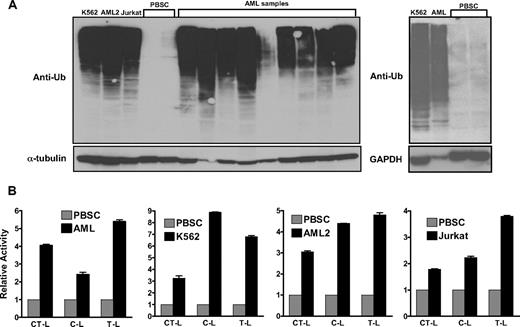 Figure 1. The activity of the ubiquitination pathway is increased in malignant cell lines and primary patient samples. (A) Total cellular proteins were isolated from leukemia cell lines, primary AML patient samples, and normal hematopoietic cells (PBSCs). Equal amounts of protein were analyzed by SDS-PAGE followed by immunoblotting with anti-ubiquitin, anti–α-tubulin, or anti-GAPDH antibodies (the latter as protein loading control). (B) Proteasome chymotrypsin-like (CT-L), caspase-like (C-L), and trypsin-like (T-L) activities were measured in primary AML (n = 12), primary normal hematopoietic cells (n = 6), and leukemia cell lines as described in “20S proteasome assays” with the use of cell lysates that were prepared from the samples that included those used for immunoblotting assays in panel A. Data represent the mean fold increase ± SD activity compared with the PBSC normal controls.