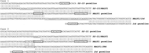 Figure 1. Comparison of the DNA sequences at the direct MALT1-JH and reciprocal DH-MALT1 breakpoint junctions and the IGH and MALT1 germline. The IGH-MALT1 fusion products of the cases 1 and 2 are aligned with germline sequences of IGH (GenBank accession no. X97051.1) and MALT1 (GenBank accession no. AC104971). Nucleotide homologies to the germline are represented by vertical lines and mismatches by dots. De novo nucleotide additions are underlined. Solid boxes indicate RSS heptamers in the JH and DH segment germlines and a cryptic RSS heptamer and nonamer in the MALT1 germline. Dashed line boxes in case 2 indicate the 6-bp microhomologous sequence flanking the translocation breakpoint.