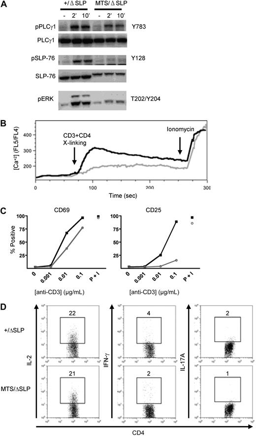 Figure 5. MTS/ΔSLP CD4+ T cells have impaired TCR signaling and are not poised to produce pro-inflammatory cytokines. (A) Purified peripheral T cells were stimulated for indicated lengths of time with a TCR cross-linking antibody, lysed, and blotted for phospho-PLC-γ1, total PLC-γ1, phospho-SLP-76, total SLP-76, and phospho-ERK. Data are representative of 3 independent experiments. (B) Peripheral cells from +/ΔSLP (black line) and MTS/ΔSLP (gray line) mice were loaded with the calcium indicator Indo-1 and analyzed for their ability to flux calcium in response to CD3/CD4 cross-linking and ionomycin at the indicated time points. Histograms are gated on YFP+CD4+ T cells. Data are representative of 3 independent experiments using 1 or 2 mice per group. (C) Splenocytes isolated from either +/ΔSLP (black line) or MTS/ΔSLP (gray line) mice were cultured in the presence of the indicated stimulus and stained for the early activation markers CD25 and CD69. Percentages are taken from positive gates set on the total YFP+CD4+ T-cell population. Data shown are representative of 3 independent experiments. P + I indicates PMA plus ionomycin. (D) Peripheral cells isolated from +/ΔSLP and MTS/ΔSLP mice after tamoxifen treatment were stimulated with PMA plus ionomycin and stained for the presence of intracellular inflammatory cytokines. Populations are gated on YFP+CD4+ T cells. Data are representative of 5 independent experiments using 2 or 3 mice per group.