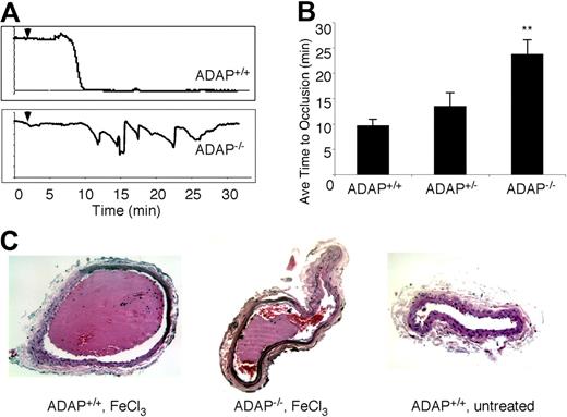 Figure 1. ADAP−/− mice exhibit abnormal thrombus formation in vivo. (A) Representative carotid artery blood flow tracings from ADAP+/+ and ADAP−/− mice. A filter paper impregnated with 3.75% FeCl3 was applied for 3 minutes (▼), and blood flow was monitored for an additional 25 minutes. (B) The average time to first occlusion was determined for each mouse, and results are shown as the average ± SEM of at least 7 mice per strain. *P < .01. (C) Hematoxylin and eosin–stained sections through the carotid artery excised 30 minutes after application of FeCl3 (ADAP+/+, left; ADAP−/−, middle) or buffer (ADAP+/+, right).