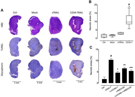 Figure 5. A single injection of CD34-TRAIL+ cells induces tumor necrosis. (A) NOD/SCID mice bearing subcutaneous tumor nodules 10 mm in diameter were randomly assigned to receive CD34-TRAIL+ cells, mock-transduced CD34+ cells (3 × 106 cells/mouse, intravenously), recombinant sTRAIL (500 μg/mouse, intraperitoneally), or control vehicle. Hematoxylin and eosin, TUNEL, and glycophorin A staining was performed. Objective lens, original magnification: 0.08 NA dry objective, 2×. (B) Quantification of necrotic areas by ImageJ analysis on digitally acquired tissue sections stained with TUNEL. At least 6 sections from different animals were analyzed per treatment group. The boxes extend from the 25th to the 75th percentiles, the lines indicate the median values, and the whiskers indicate the range of values. *P < .001, compared with controls. #P < .001, compared with sTRAIL. (C) Injection of anti–VCAM-1 and AMD3100 reduced tumor necrosis in mice treated with CD34-TRAIL+ cells. Necrotic areas (± SD) were quantified by ImageJ analysis. Data from 1 representative experiment are shown. #P < .001, compared with control. *P = .002, compared with CD34-TRAIL+ cells. **P = .02, compared with CD34-TRAIL+ cells. ***P = .003, compared with CD34-TRAIL+ cells.
