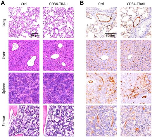 Figure 6. Tissue and vascular toxicity in healthy tissue after CD34-TRAIL+ cell administration. NOD/SCID mice bearing subcutaneous tumor nodules received a single intravenous injection of CD34-TRAIL+ cells (3 × 106 cells/mouse) or control vehicle. Forty-eight hours after treatment, lung, liver, spleen, and femur were harvested and analyzed. (A) Hematoxylin and eosin and (B) immunohistochemical staining with anti-CD31 antibody demonstrated the absence of tissue or vascular damage. Representative histologic images are shown. Objective lens, original magnifications: (A) 0.4 NA dry objective, 10×; (B) 0.75 NA dry objective, 20×.