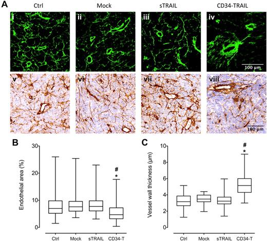 Figure 7. Antivascular effects of CD34-TRAIL+ cells. (A) NOD/SCID mice bearing subcutaneous tumor nodules 10 mm in diameter were randomly assigned to receive CD34-TRAIL+ cells, mock-transduced CD34+ cells (3 × 106 cells/mouse, intravenously), recombinant sTRAIL (500 μg/mouse, intraperitoneally), and control vehicle. Forty-eight hours after treatment, NOD/SCID mice were intravenously injected with 0.2 mL of sulfo-NHS-LC-biotin (5 mg/mL) to biotinylate tumor vasculature. Tumors were then excised, and biotinylated endothelium was revealed by AlexaFluor 488–streptavidin for confocal microscopy analysis (i-iv; 40×/1.0 NA oil objective) or sequentially incubated with HRP-streptavidin and 3,3′-diaminobenzidine for light microscopy analysis (v-viii; 20×/0.75 NA dry objective). After counterstaining with hematoxylin, sections were analyzed using ImageJ for quantification of vascular parameters. Representative confocal and histologic images of in vivo biotinylated mice receiving the different treatments are shown. (B) Endothelial area was calculated on whole tissue sections as (streptavidin-HRP stained area)/(total tissue area) × 100. *P < .001, compared with controls. #P < .001, compared with sTRAIL. (C) Vessel wall thickness was calculated on transversally oriented vessels. *P < .001, compared with controls. #P < .001, compared with sTRAIL.