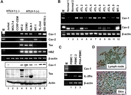Figure 1. Caveolin-1 is consistently expressed in HTLV-1–infected T-cell lines and primary ATL cells. (A) Expression of caveolin-1, caveolin-2, Tax, and HBZ in HTLV-1–infected T-cell lines. RT-PCR analysis was carried out for caveolin-1, caveolin-2, Tax, HBZ, and β-actin (loading control). Western blot analysis was performed for caveolin-1, Tax, and actin. The dotted line indicates the grouping of images from different parts of the same gel. Representative results of 3 separate experiments with similar results. (B) RT-PCR analysis for expression of caveolin-1 and caveolin-2 in normal PBMCs and primary ATL cells. Normal PBMCs from healthy donors (n = 2) and freshly isolated primary ATL cells (> 90% leukemic cells) from patients (n = 9) were examined as indicated. Representative results of 3 separate experiments with similar findings. (C) Expression of caveolin-1 and IL-2Rα in PHA-stimulated or unstimulated PBMCs. Normal PBMCs were treated with PHA for 3 days (PHA-PBMC). Representative results of 3 separate experiments with similar findings. (D) Immunohistochemical staining of caveolin-1 in ATL lymph node and skin lesions. Tissue sections from ATL lymph nodes (n = 6) and skin lesions (n = 10) were stained with anti–caveolin-1 antibody. Tissue sections were counterstained with methyl green. Representative results from a single donor. Original magnification, ×400. Cav indicates caveolin.