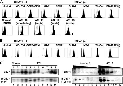 Figure 2. Membrane expression of caveolin-1 in HTLV-1–infected T-cell lines and primary ATL cells and detection of caveolin-1 in plasma. (A) Flow cytometric analysis of T-cell lines and PBMCs derived from a healthy donor and patients with ATL. Cells were stained for caveolin-1 with phycoerythrin-conjugated monoclonal anti–caveolin-1 antibody. (B) Detection of intracellular Tax protein expression in HTLV-1–transformed T-cell lines. The Tax protein was detected with the Lt-4 monoclonal antibody. (C) Detection of caveolin-1 in plasma. Plasma samples from healthy donors (n = 2) and patients with acute-type ATL (n = 9) were screened by Western blot (left). Plasma was serially diluted (1:2, 1:40, 1:100, 1:200, 1:400, and 1:1000) and loaded (right). Phosphorylated caveolin-1 in plasma was also determined by Western blot with the use of a phosphospecific monoclonal antibody that selectively recognizes only Tyr-14 phosphorylated caveolin-1. Representative results of 3 separate experiments with similar findings.